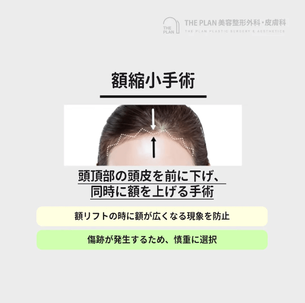 韓国額リフト