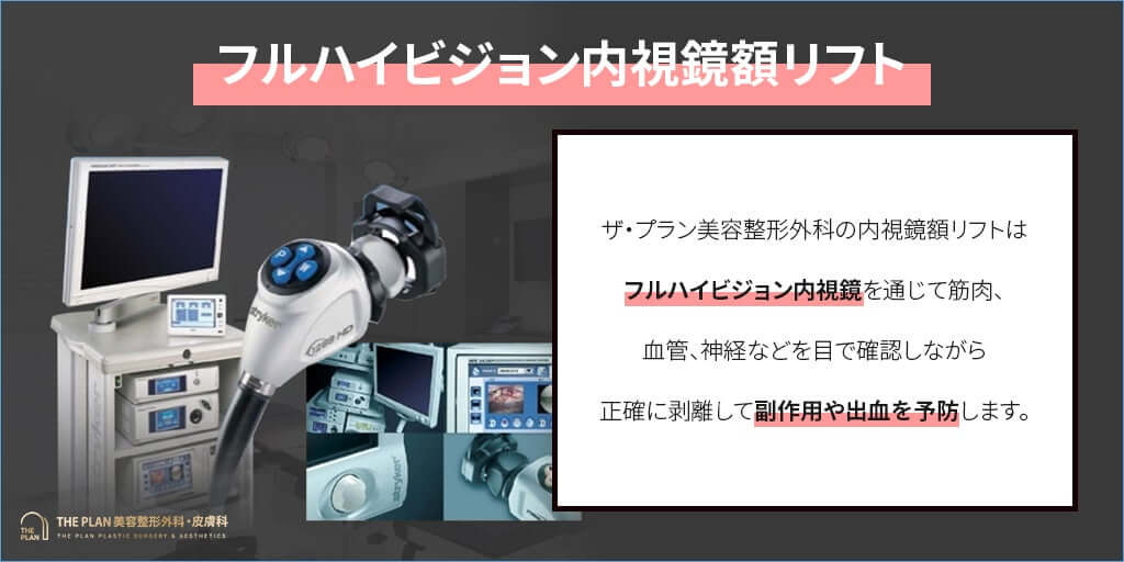 韓国切開リフト名医