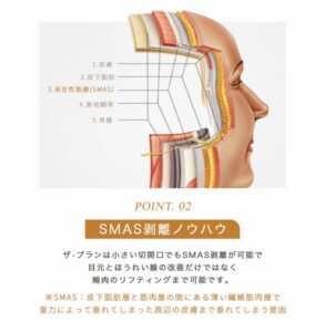 SMASの説明
