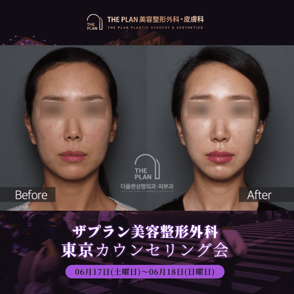 6月に行われる予定のザプラン美容整形外科のカウンセリング会の案内写真です。
