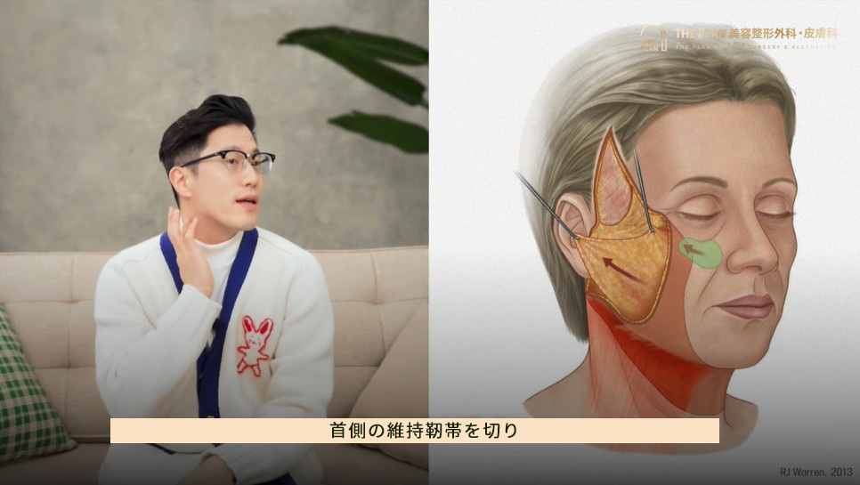 パク·ジュンヒョン代表院長が教える切開リフトの方法