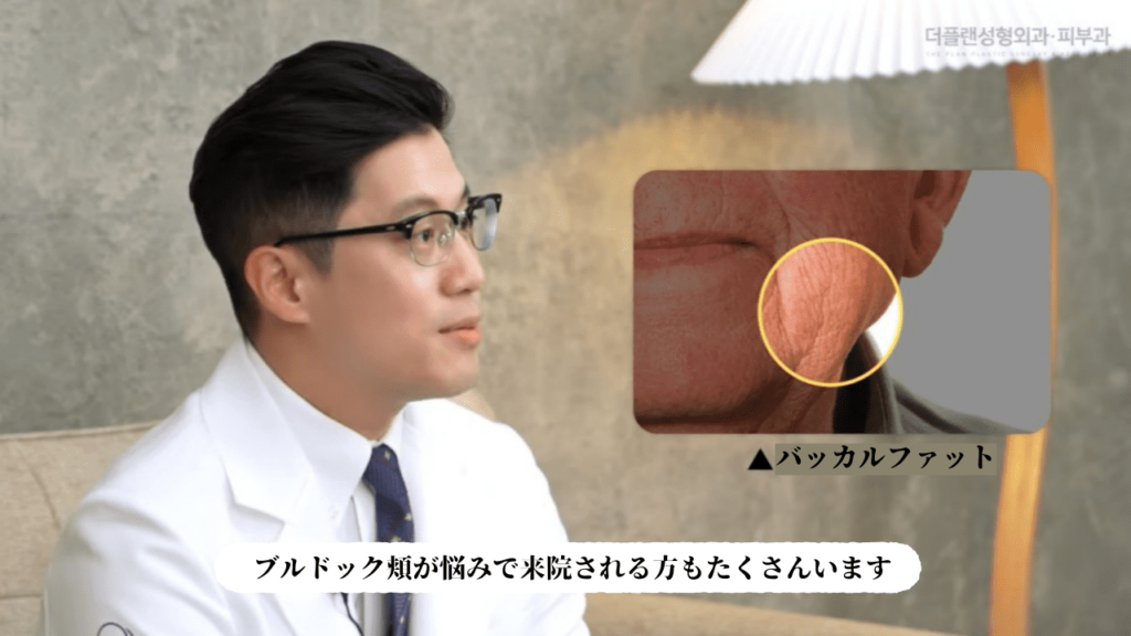 バッカルファットの改善と除去方法についての説明画像