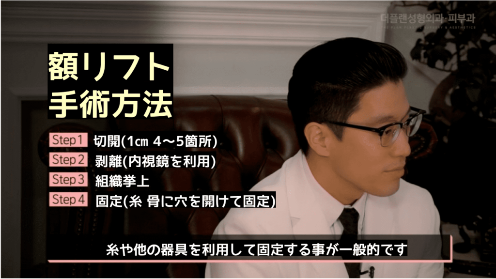額挙上術の方法について詳しく説明した画像。