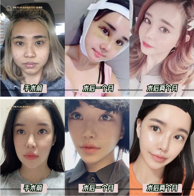 before and after photos