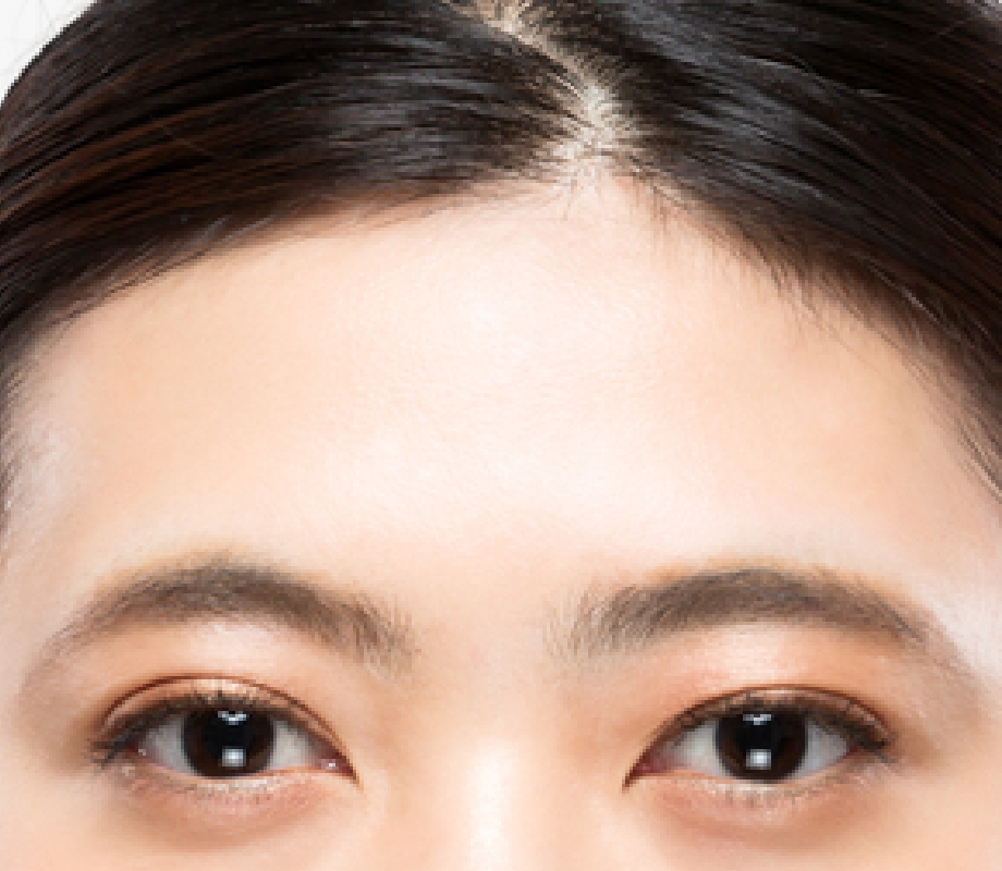 corrects eye contour and prevents forehead wrinkles
