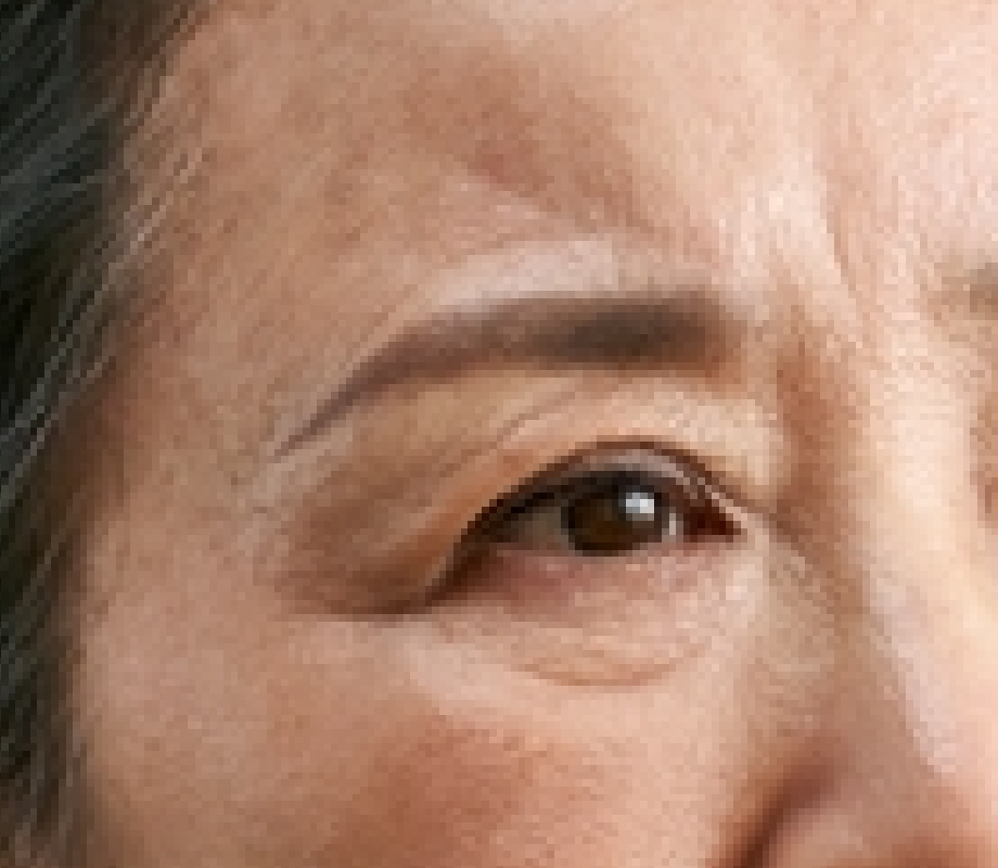 sagging skin under your eyes