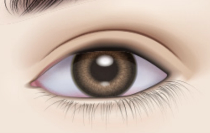 Aftercare is needed