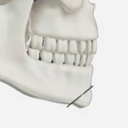 chin tip Protruding Chin step 3