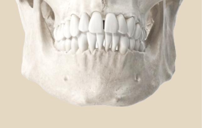 long jawline surgery step 1